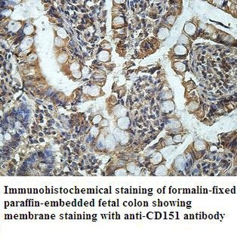 CD151 Rabbit Polyclonal Antibody