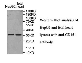 CD151 Rabbit Polyclonal Antibody