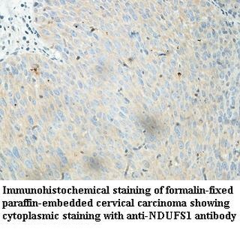 NDUFS1 Rabbit Polyclonal Antibody