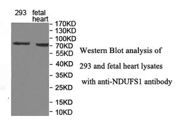 NDUFS1 Rabbit Polyclonal Antibody