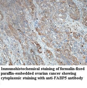 FABP5 Rabbit Polyclonal Antibody