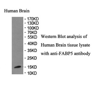 FABP5 Rabbit Polyclonal Antibody