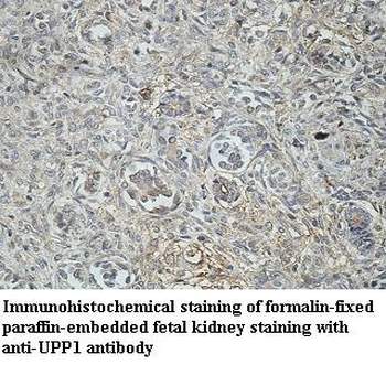 UPP1 Rabbit Polyclonal Antibody