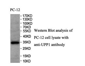 UPP1 Rabbit Polyclonal Antibody