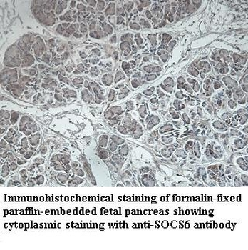 SOCS6 Rabbit Polyclonal Antibody