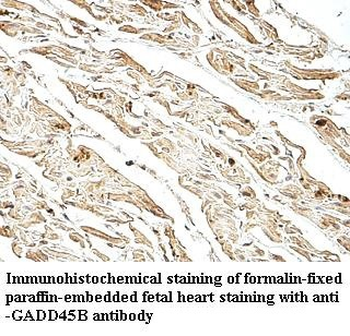 GADD45B Rabbit Polyclonal Antibody