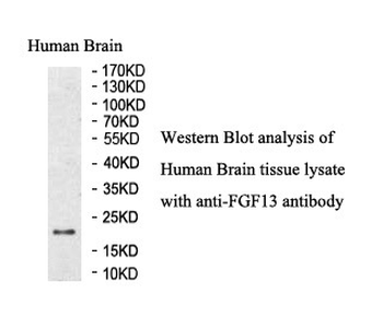 FGF13 Rabbit Polyclonal Antibody