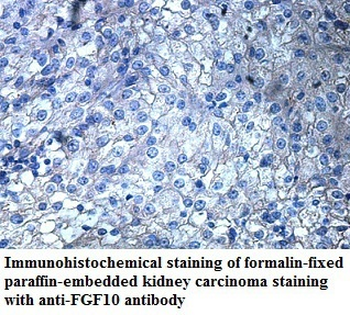 FGF10 Rabbit Polyclonal Antibody