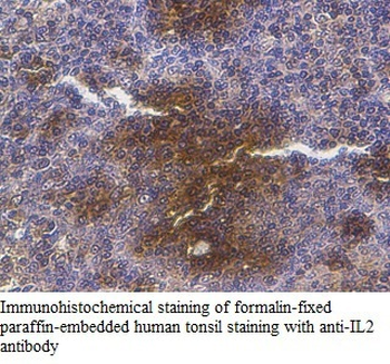 IL2 Rabbit Polyclonal Antibody