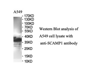 SCAMP1 Rabbit Polyclonal Antibody