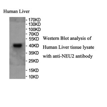 NEU2 Rabbit Polyclonal Antibody
