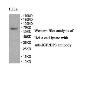 IGF2BP3 Rabbit Polyclonal Antibody
