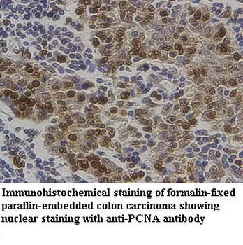 PCNA Rabbit Polyclonal Antibody