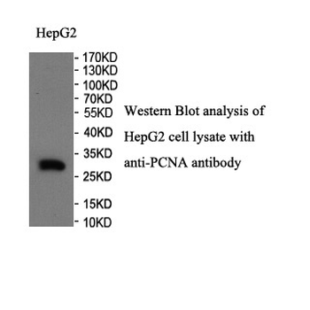 PCNA Rabbit Polyclonal Antibody