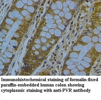 PVR Rabbit Polyclonal Antibody