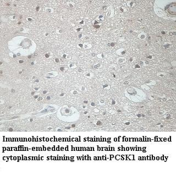 PCSK1 Rabbit Polyclonal Antibody