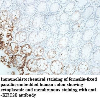 KRT20 Rabbit Polyclonal Antibody