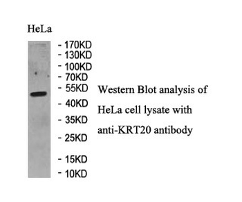 KRT20 Rabbit Polyclonal Antibody