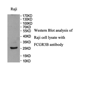 FCGR3B Rabbit Polyclonal Antibody