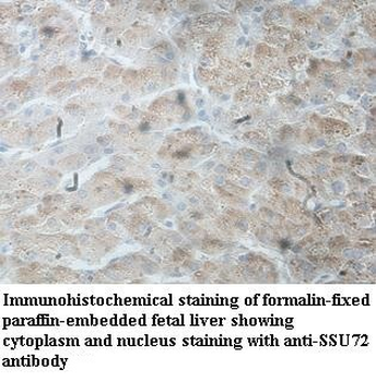 SSU72 Rabbit Polyclonal Antibody