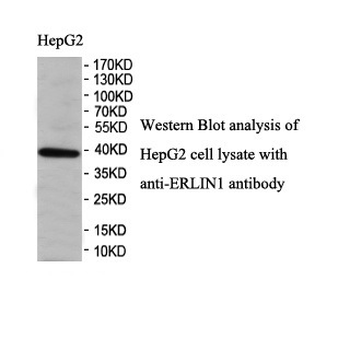 ERLIN1 Rabbit Polyclonal Antibody