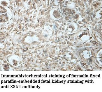 SSX1 Rabbit Polyclonal Antibody