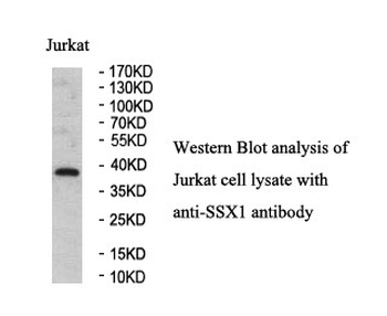 SSX1 Rabbit Polyclonal Antibody