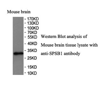 SPSB1 Rabbit Polyclonal Antibody