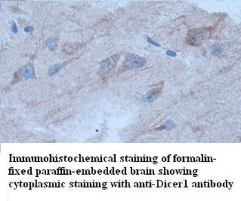 Dicer1 Rabbit Polyclonal Antibody