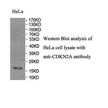 CDKN2A Rabbit Polyclonal Antibody