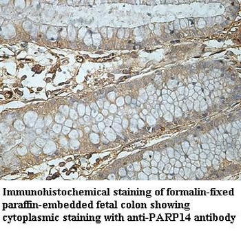 PARP14 Rabbit Polyclonal Antibody
