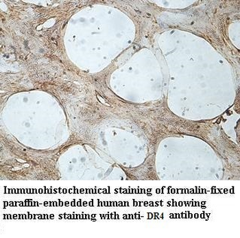 DR4 Rabbit Polyclonal Antibody