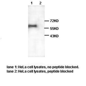 DR4 Rabbit Polyclonal Antibody