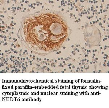 NUDT6 Rabbit Polyclonal Antibody