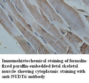 NUDT6 Rabbit Polyclonal Antibody