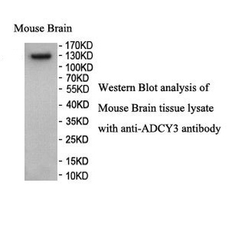 ADCY3 Rabbit Polyclonal Antibody