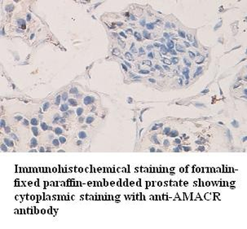 AMACR Rabbit Polyclonal Antibody