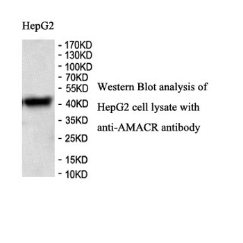 AMACR Rabbit Polyclonal Antibody