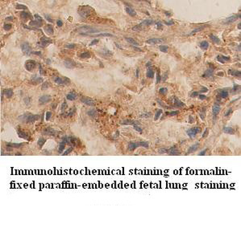 ANG4 Rabbit Polyclonal Antibody