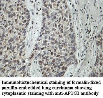 AP1G1 Rabbit Polyclonal Antibody
