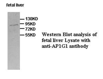 AP1G1 Rabbit Polyclonal Antibody