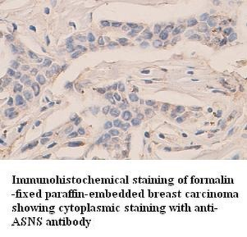 ASNS Rabbit Polyclonal Antibody