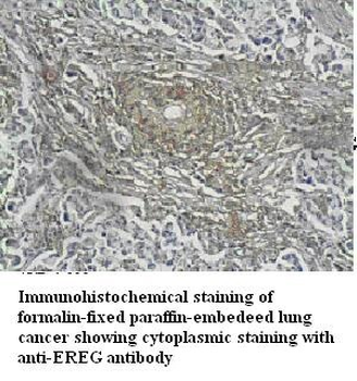 EREG Rabbit Polyclonal Antibody