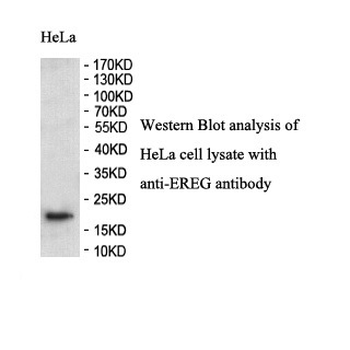 EREG Rabbit Polyclonal Antibody