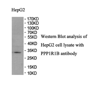 DARPP32 Rabbit Polyclonal Antibody