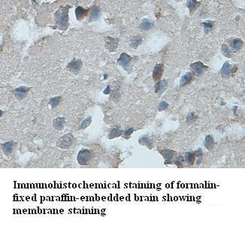 Ghsr Rabbit Polyclonal Antibody