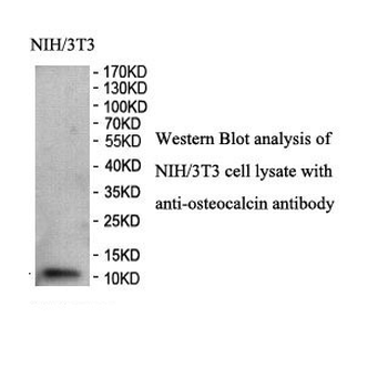 Osteocalcin Rabbit Polyclonal Antibody