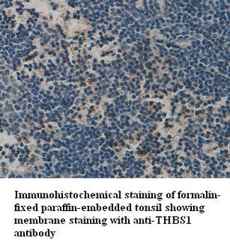 THBS1 Rabbit Polyclonal Antibody