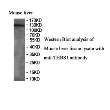 THBS1 Rabbit Polyclonal Antibody