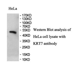 Keratin 7 Rabbit Polyclonal Antibody
